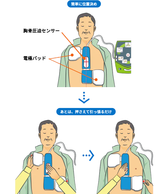 めての方でも装着しやすい一体型の除細動パッド